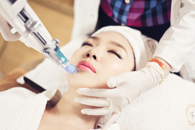 Máy truyền TBG không kim